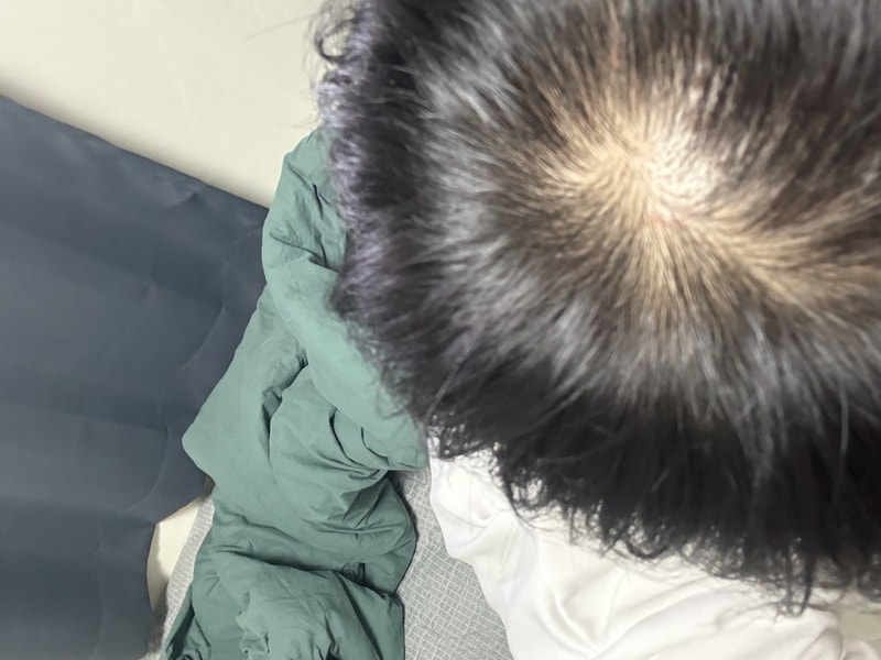 HAUM PGGMシャンプー4週目体験談です。