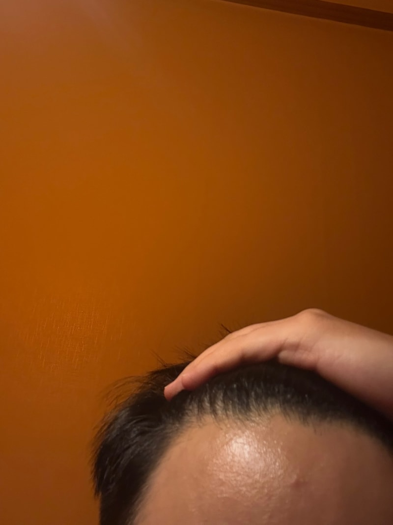 ブラックフォーレルートパワーシャンプー2週目の体験談です。