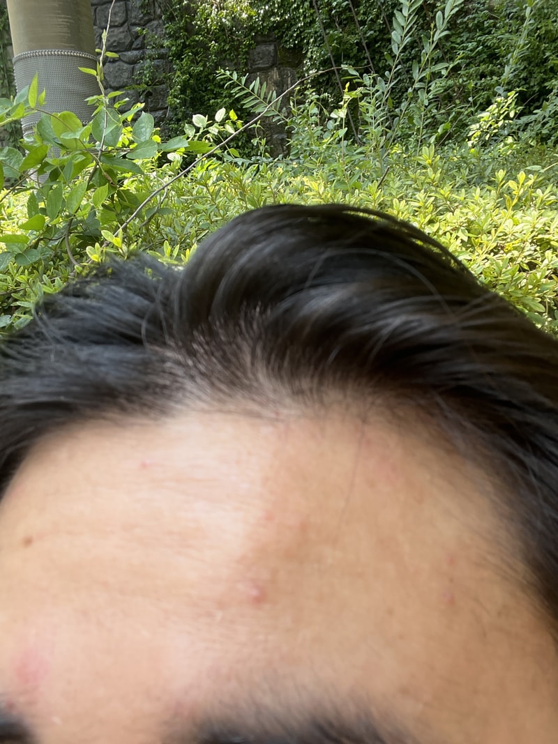 ブラックフォーレルートパワーシャンプー2週目の体験談です。