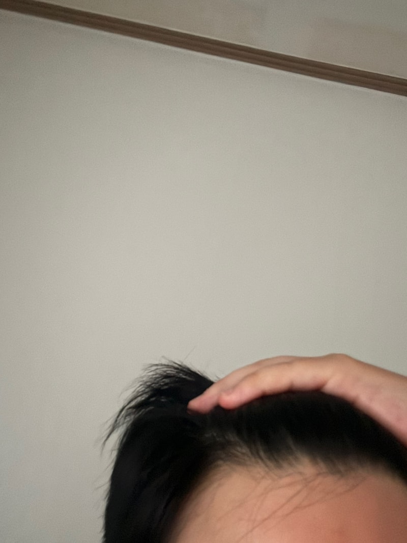 ブラックフォーレルートパワーシャンプー1週目の体験談です。