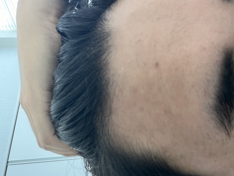 黑森林根动力洗发水第4周后期。