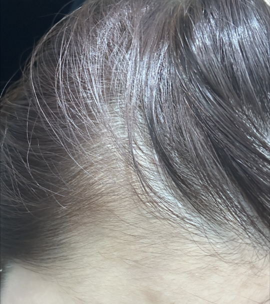 ミュリナ4週目の体験談です。