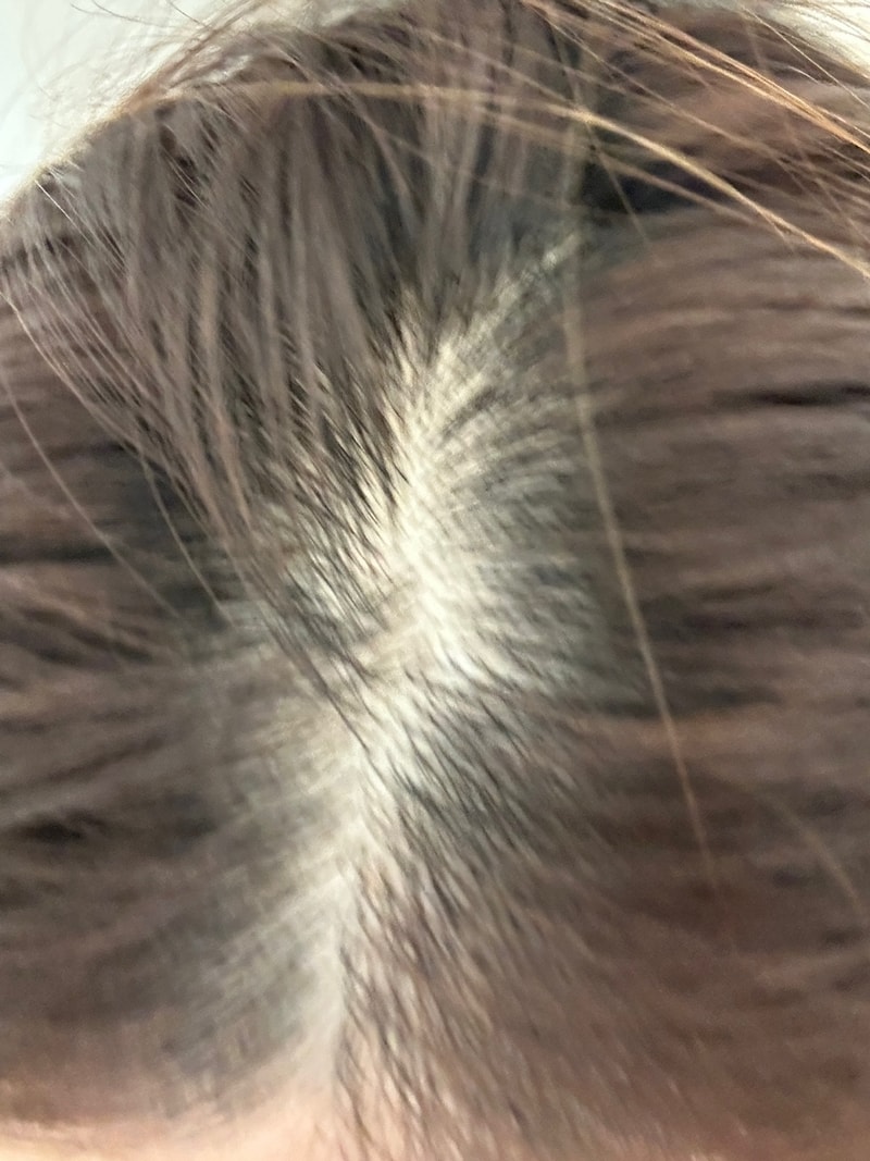 ブラックフォーレ ルートパワーシャンプー 1週目 体験談