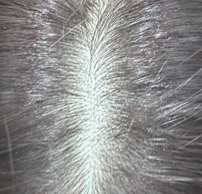 HAUM PGGM 탈모샴푸 4주차 후기