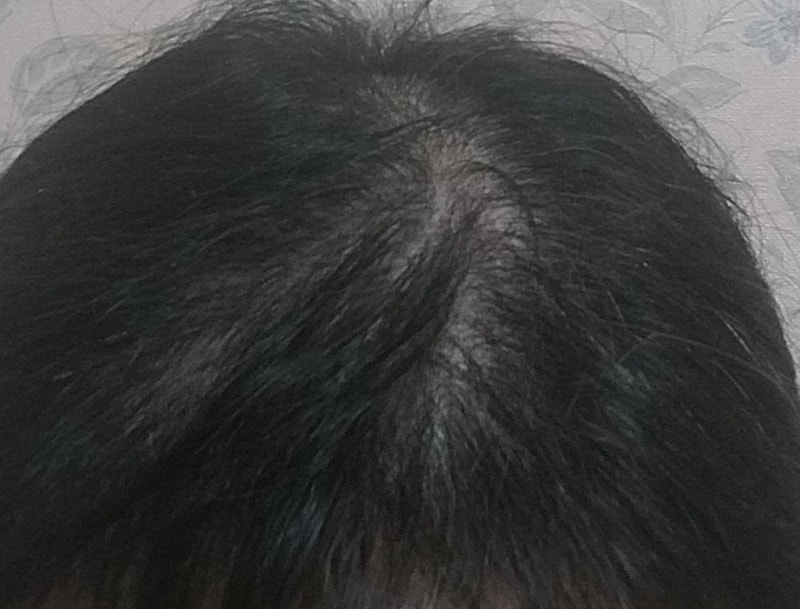 ミュリナ4週目の体験談です。