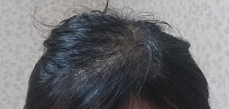 ブラックフォーレルートパワーシャンプー4週目の体験談です。