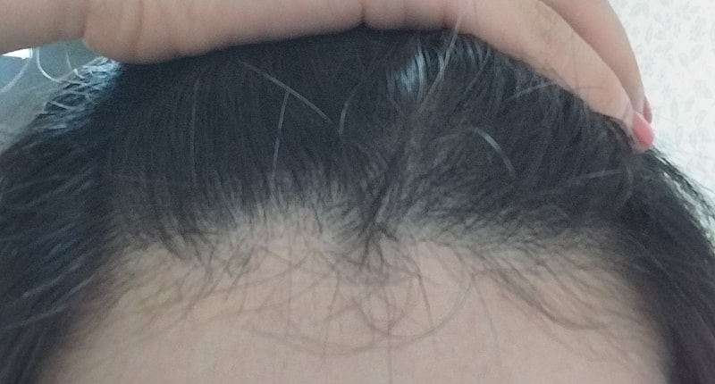 パントモナ4週目の体験談