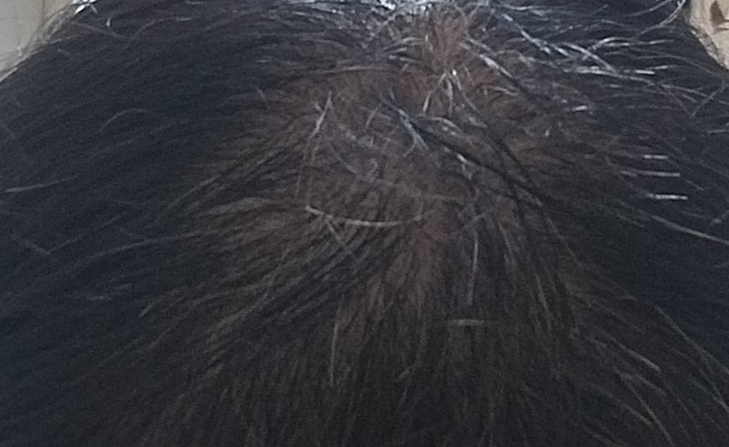 ブラックフォーレシャンプー3週目の体験談です。