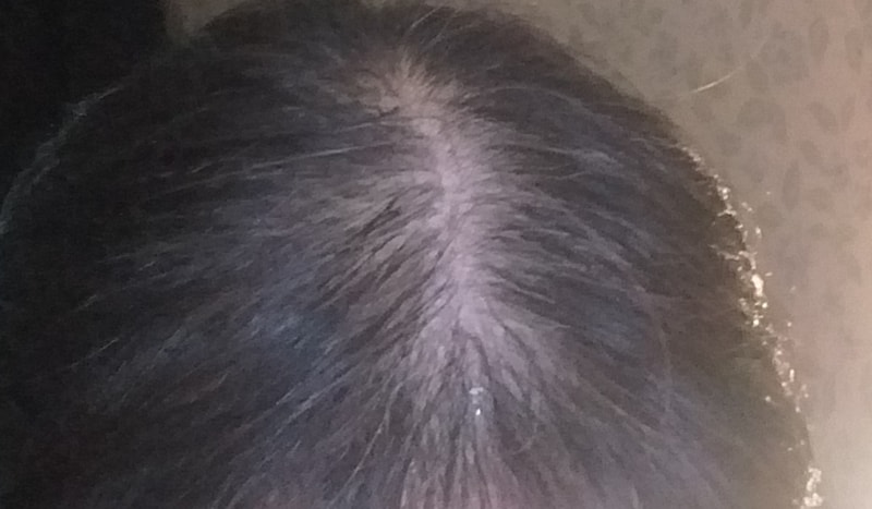 エルビーモア第1週目の体験談です。