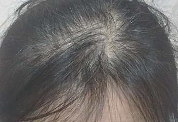 사용전