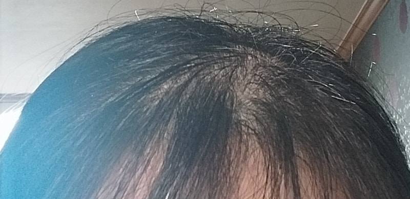 ドクターグルート2週目の体験談です。