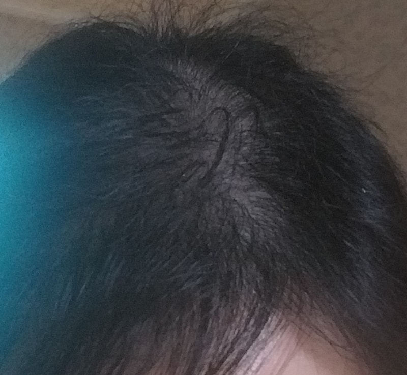 This is the review of the 3rd week of Ryeo RootGen Essence.