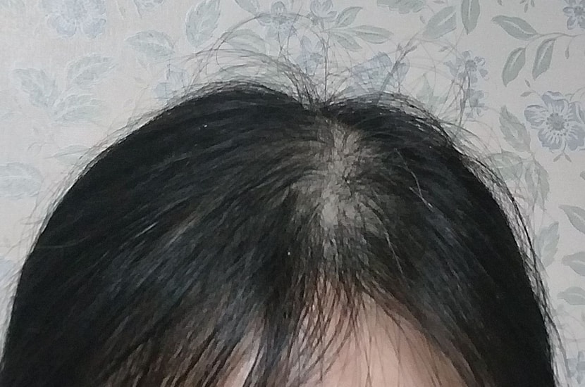 5주후