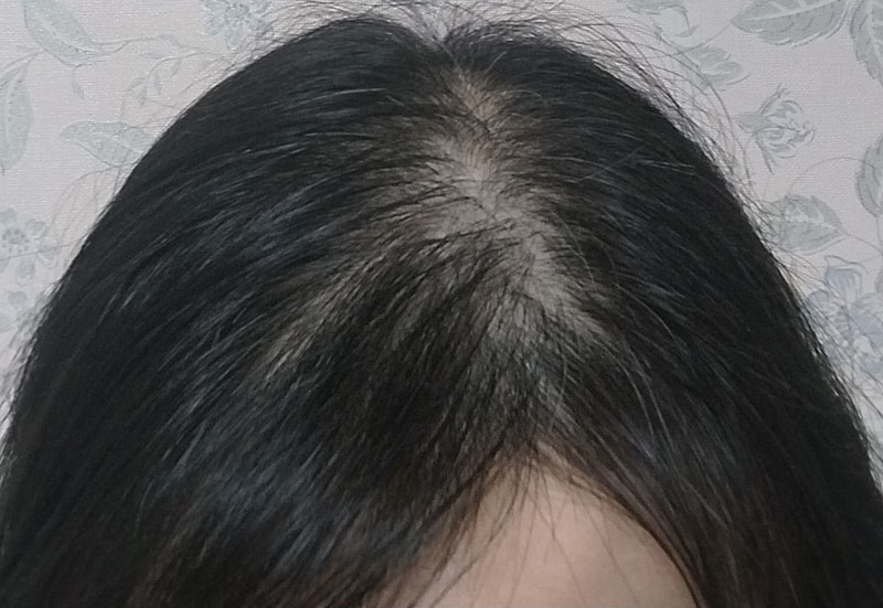 ザ·マッシモアンプル2週目の体験談です。