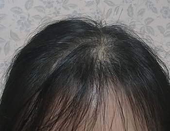 시작전