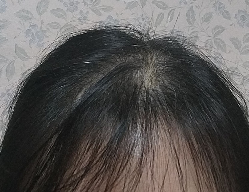 시작전