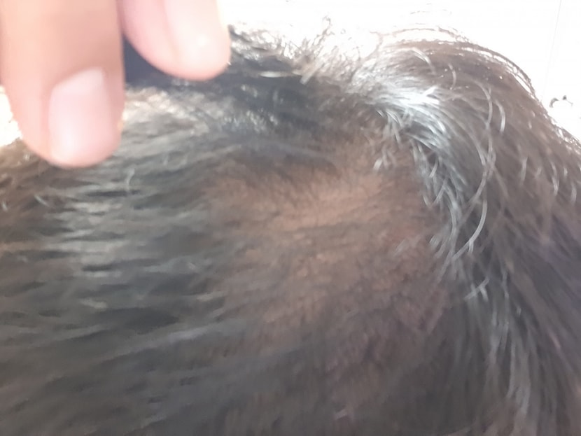 머리숱이 많아졌다는 느낌은 잘 안 나지만, 머릿결이  조금 좋아졌다는 느낌은 들어요