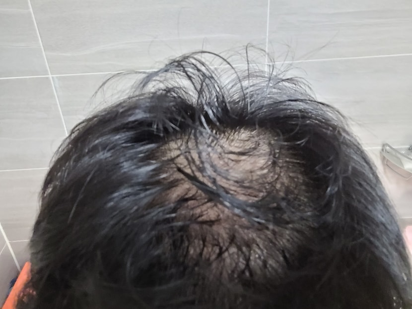 바르고 난 직후 두피 및 머리카락 상태 (많이 젖어있음)