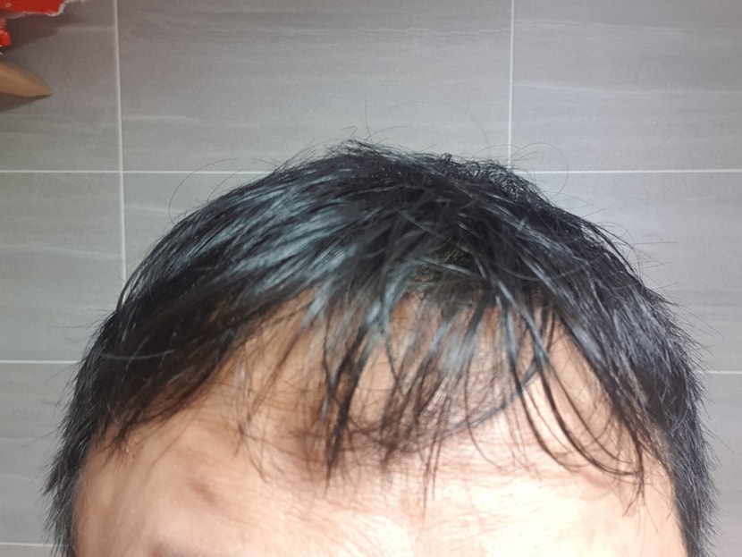 머리 감고 말린 후 모습. 나름 뽀듯뽀듯해졌어요^^