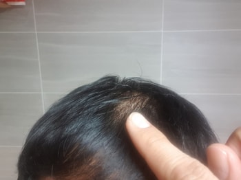 앰플액 바른 직후 - 머릿결이 젖어 있음