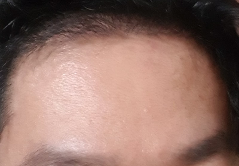 チェウムルチン ブラックフォーメン ビオチン オクタコサノール 3週目体験談