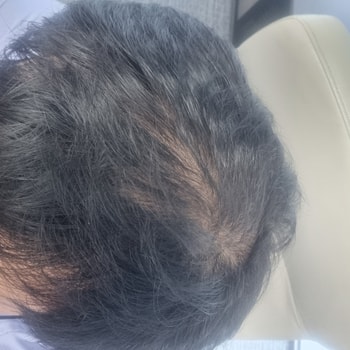 지금 오후 6시인데 유분 줄었어요