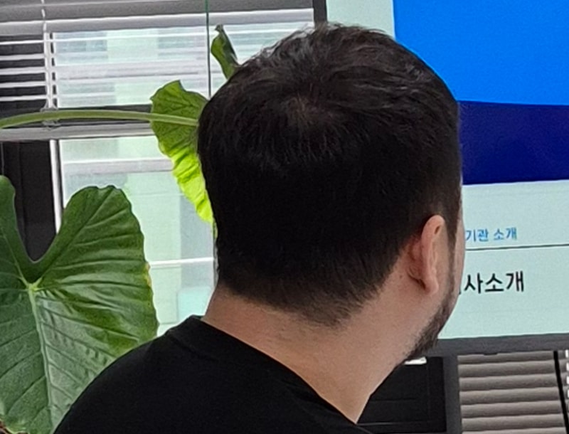 ハウムシャンプー第2週目体験談