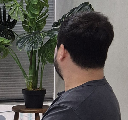 더후 샴푸 1주차 후기