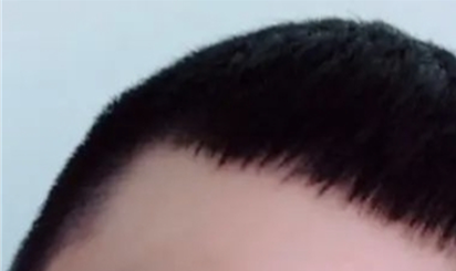 연모화로 갈라지던 앞머리가 좋아지고 있어요
