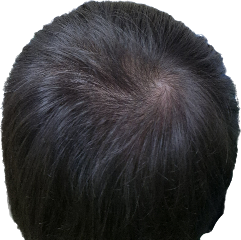 닥터포헤어 4주차 후기