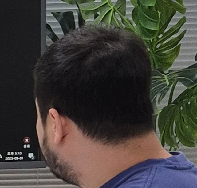 뉴프리미엄TS 샴푸 3주차 후기