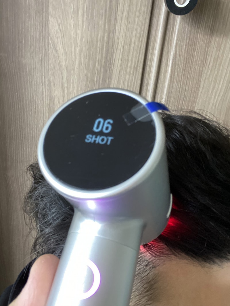 헤어미라클 체험 3주차 - 미세전류