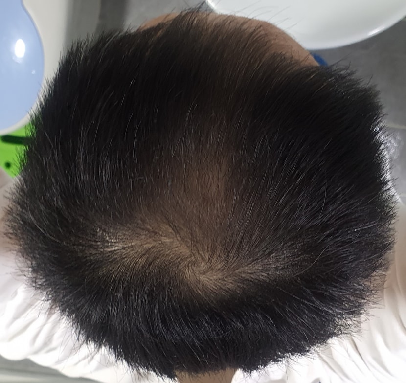 1주 사용 후