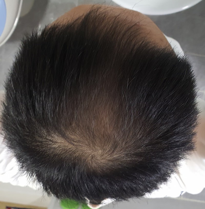 클라디에스칼프리페어 3주차 후기