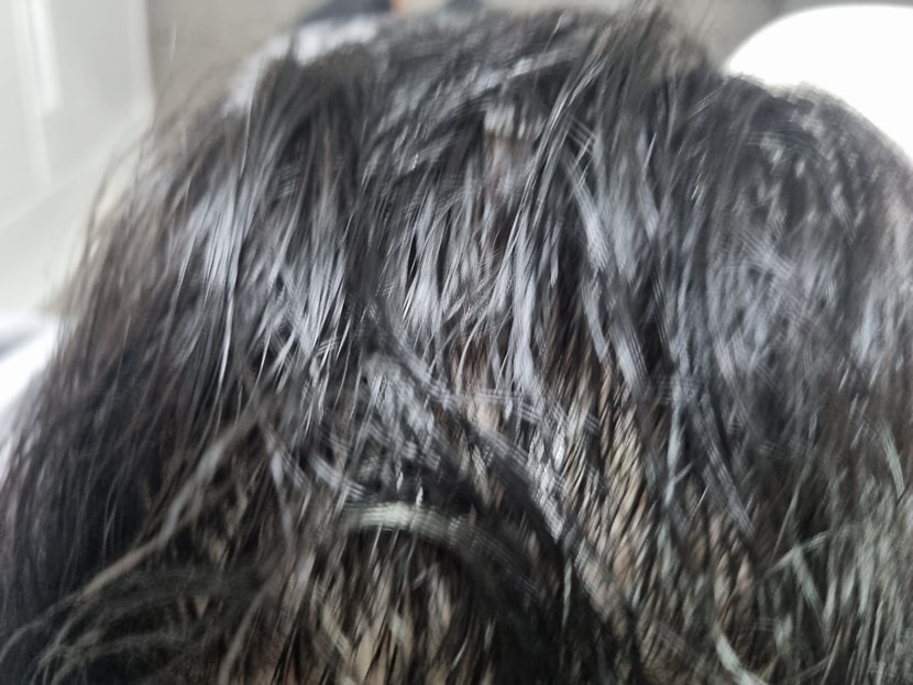 인핸싱폼 사용후