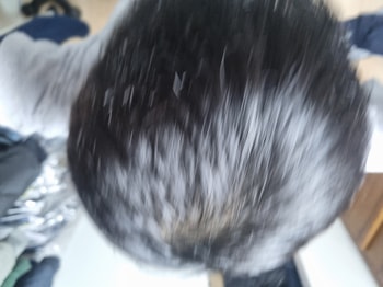 최근 머리카락 
