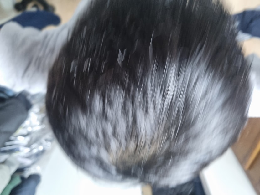 최근 머리카락 