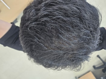 정수리 사진