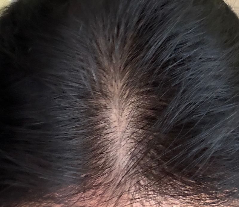 ザ·フー第1週目体験談