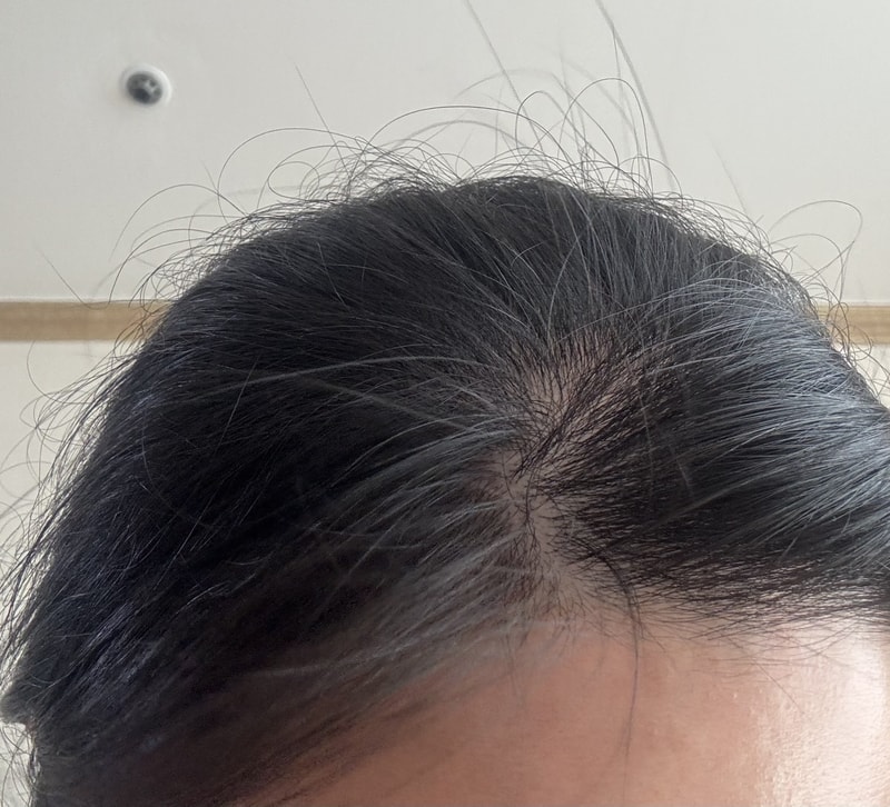 HAUMPGGM脱发洗发水1周后期