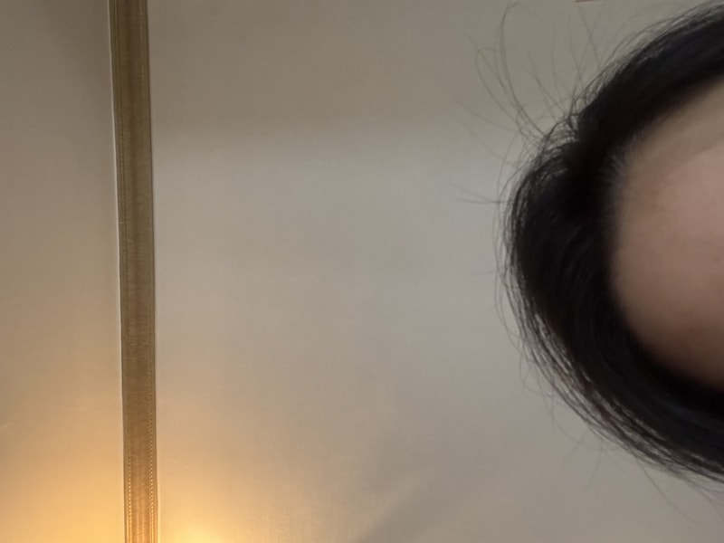 PGGM 탈모샴푸 2주차 후기