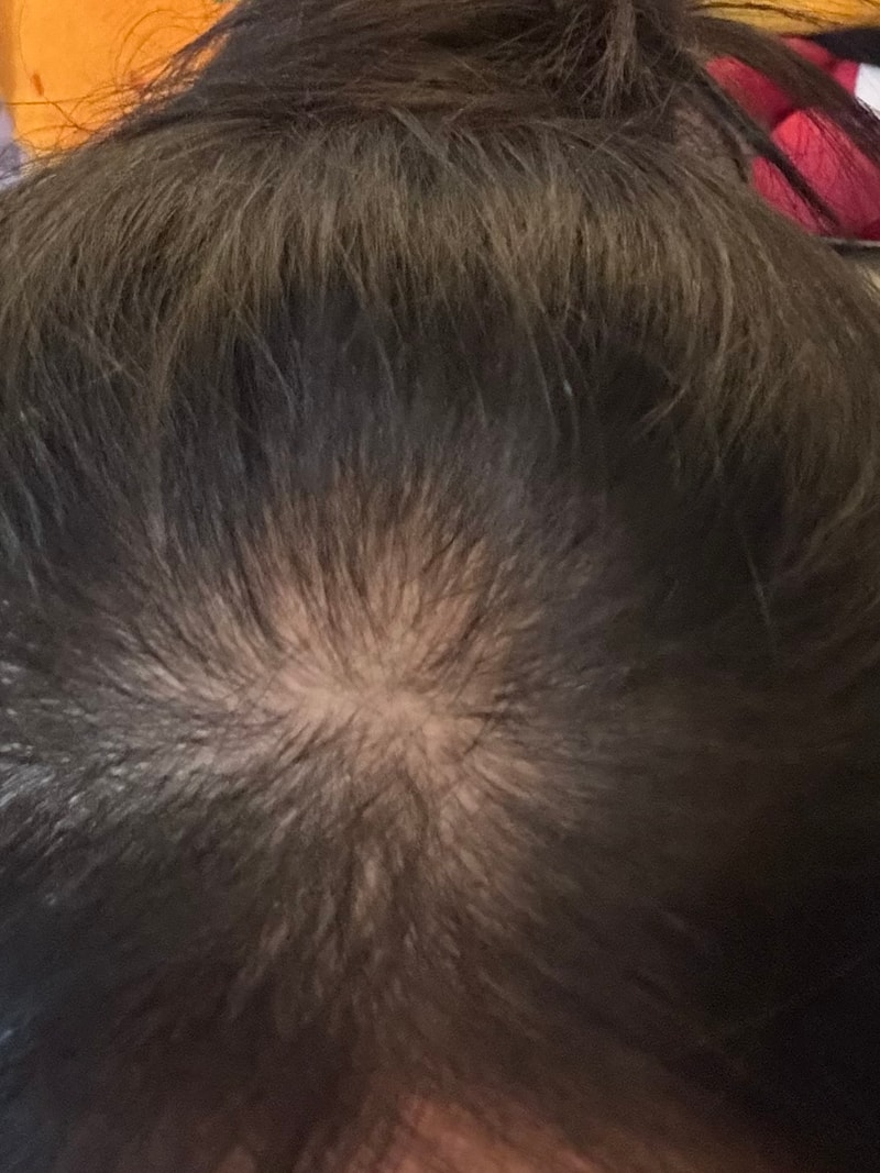 뉴프리미엄 TS샴푸 3주차