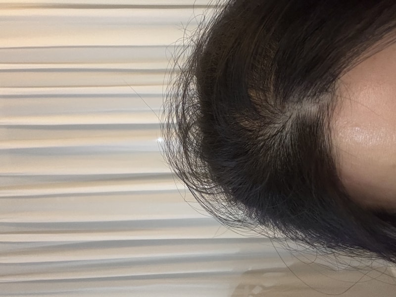 뉴프리미엄 TS샴푸 4주차