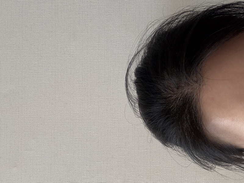 PGGM 탈모샴푸 4주차 후기