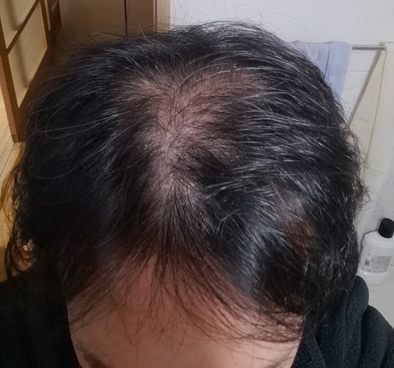 ビエルモ体験1週目の体験談