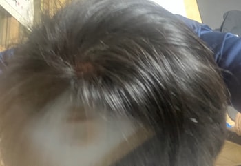 샴푸 사용 후
