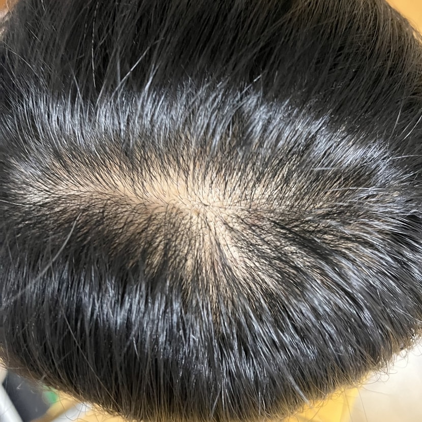 현재 제 머리상태