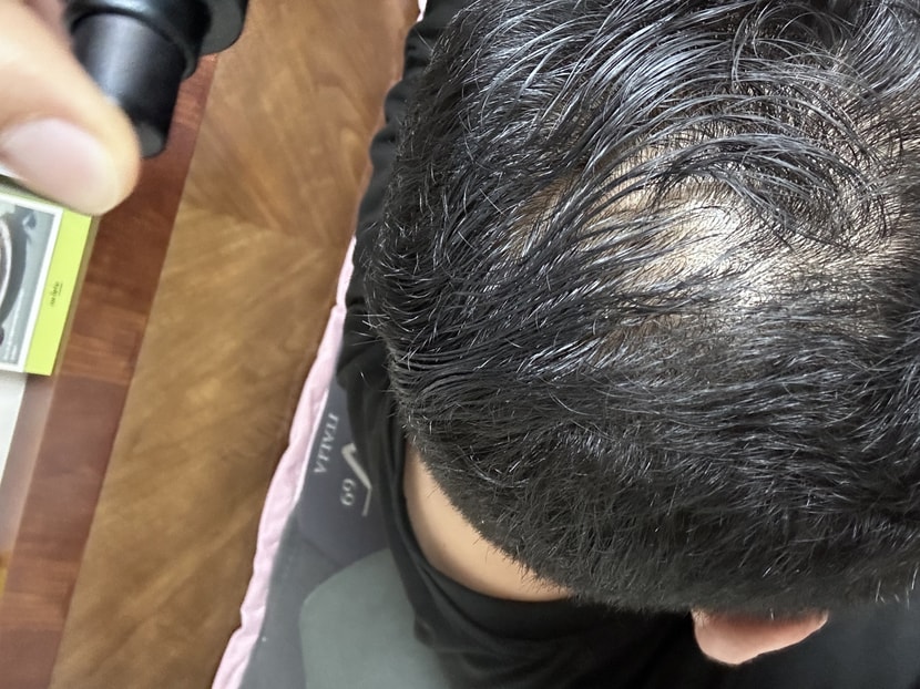 충분히 적신 후 두피 마사지 30-50분 정도 합니다. 