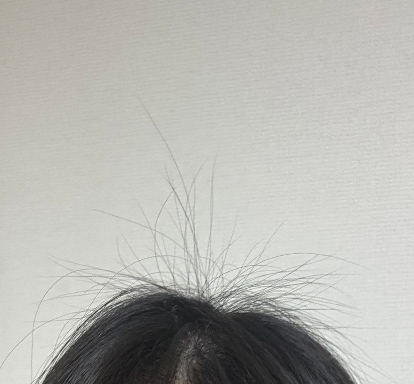 정수리 잔머리