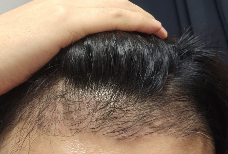 비엘모 패키지 4주차